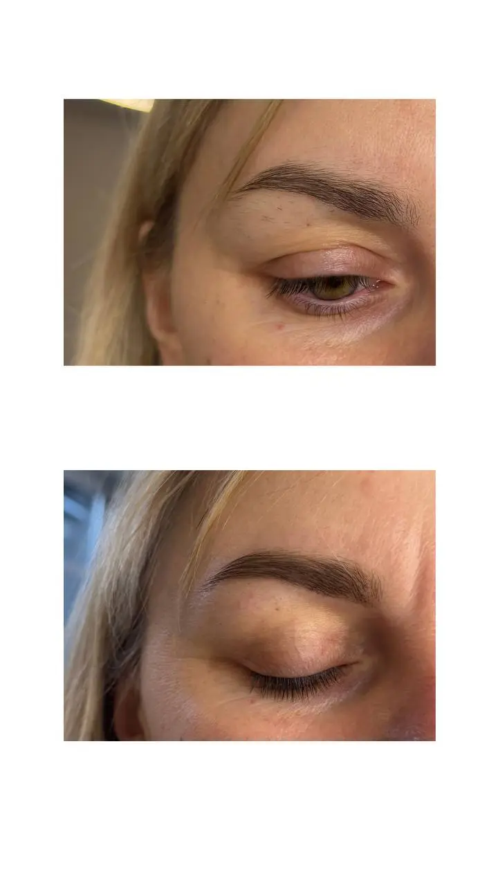 Броу баланс - результат