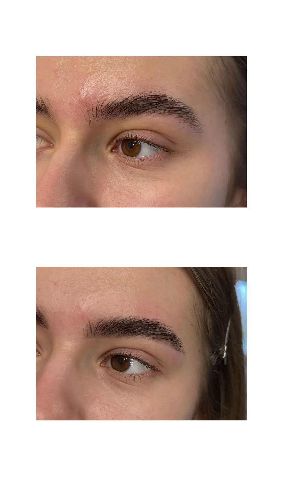 Броу баланс - результат