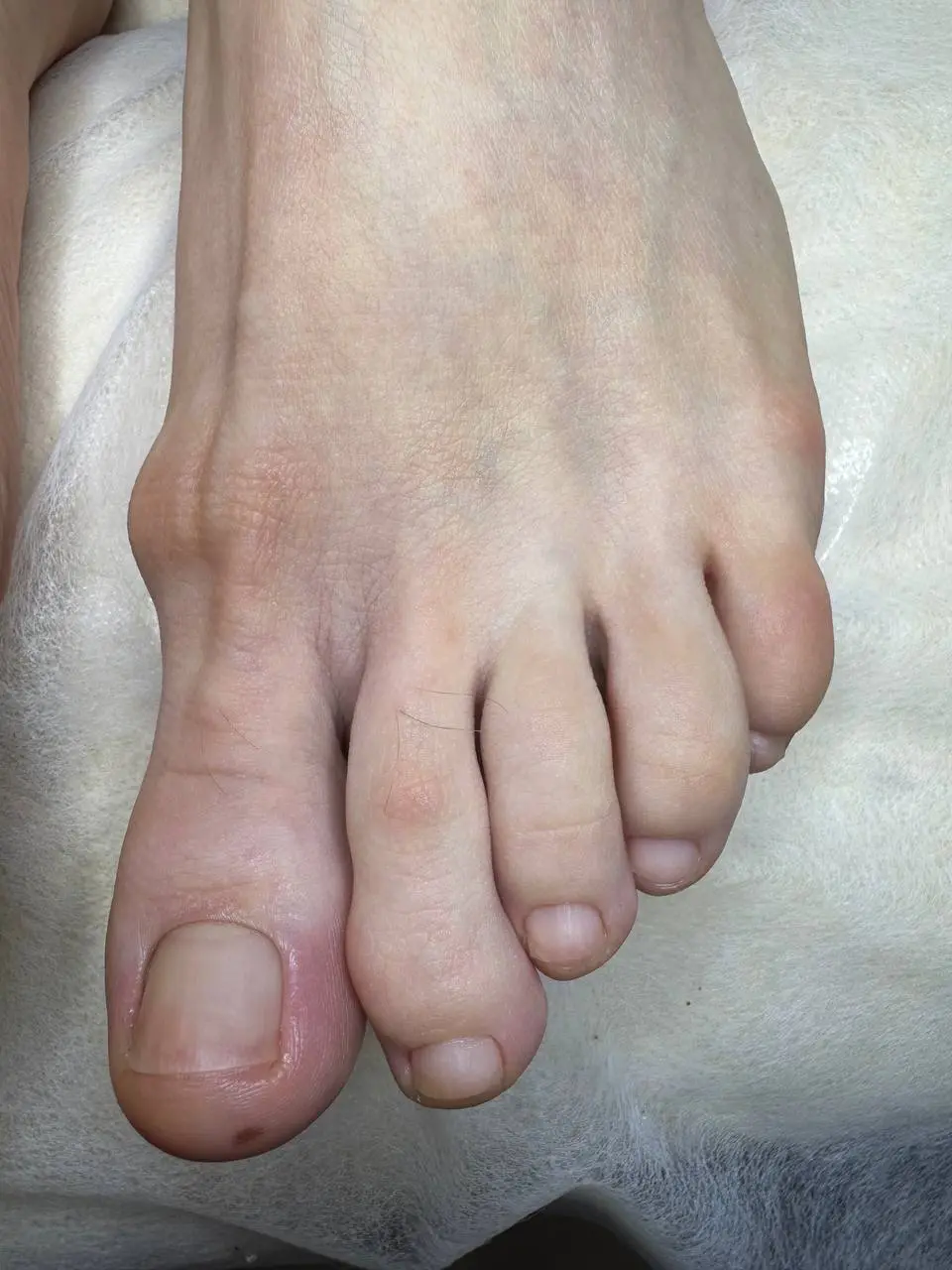 Педикюр - результат